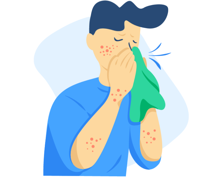 Allergies